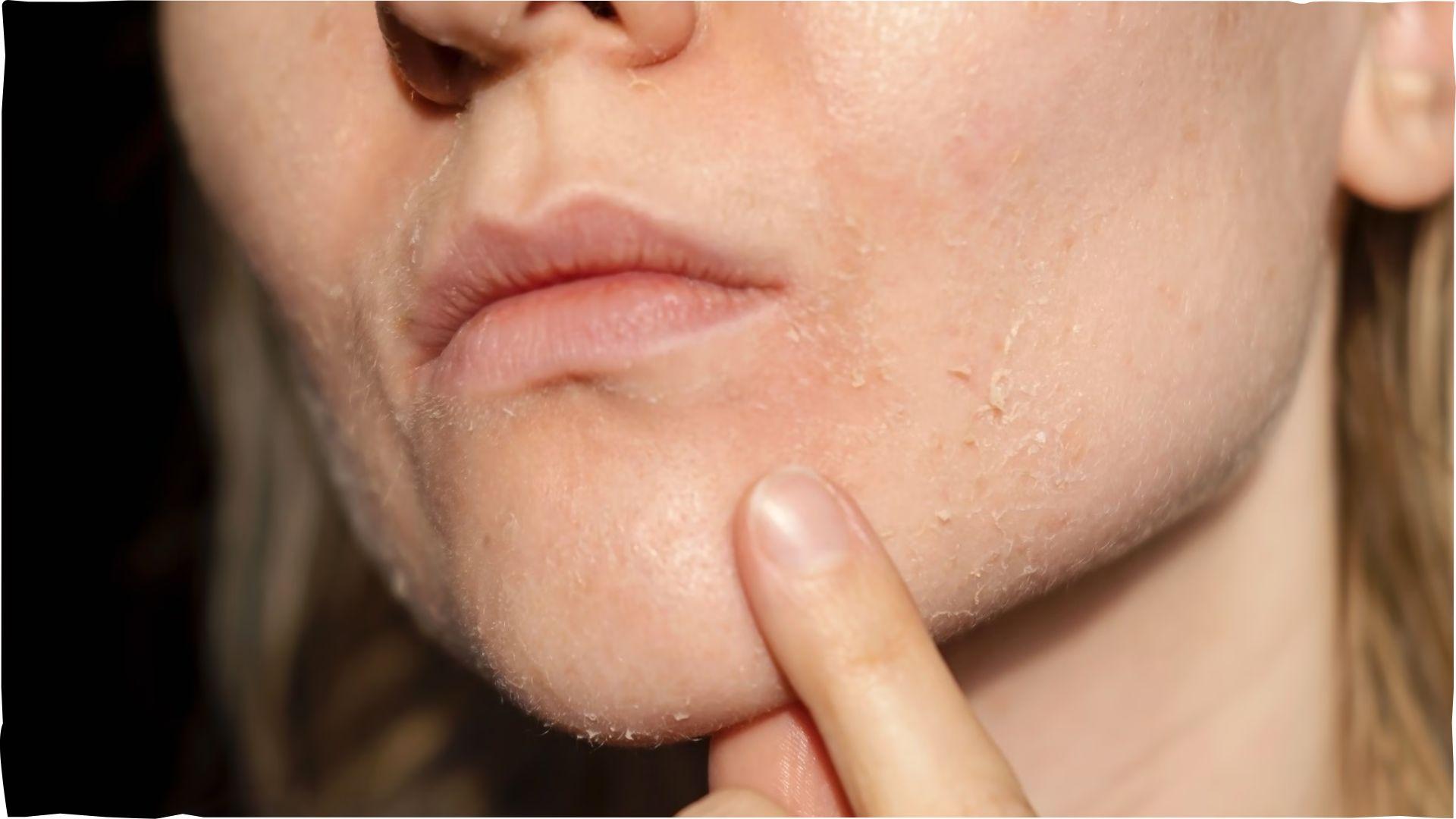 <p><span style="color: rgb(224, 62, 45);" data-mce-style="color: rgb(224, 62, 45);">ઘરે જ લગાવો આ સરળ પેક, ડ્રાય અને ઢીલી ત્વચાનો પાક્કો ઉપાય!</span> રોજ લગાવશો તો મળશે ગુલાબી નિખાર </p>